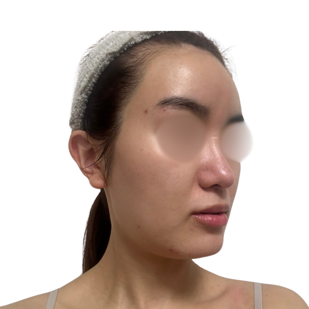 バイオリピール（ミラノリピール）